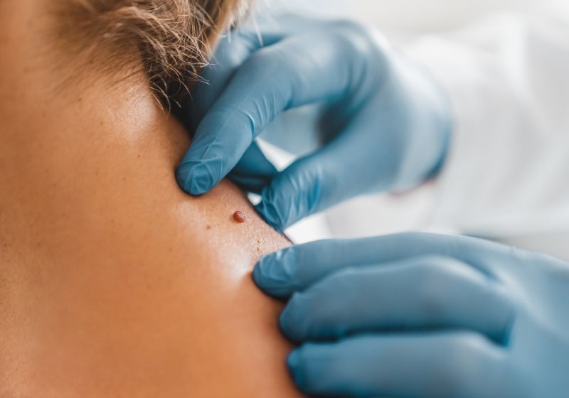 Apresentação clínica: